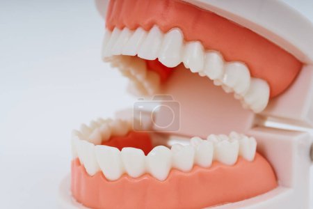 Téléchargez les photos : Un modèle dentaire et fond blanc - en image libre de droit