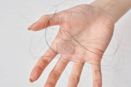 Photo for Hand of a woman with lost hair and white background - Royalty Free Image