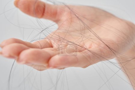 Hand of a woman with lost hair and white background