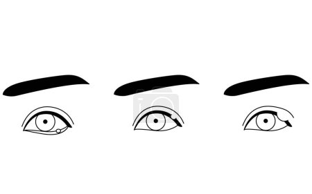 Illustration for Medical Clipart, Line Drawing Illustration of Eye Disease and Sty, chalazia, Vector Illustration - Royalty Free Image