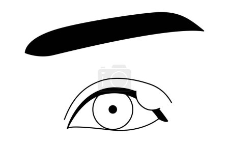 Ilustración de Clipart médico, dibujo de línea Ilustración de la enfermedad ocular y Sty, chalazia, ilustración vectorial - Imagen libre de derechos