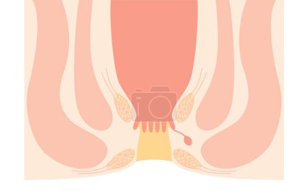 Ilustración de Human body rectum and anus area Illustrations, cross sectional view, Vector Illustration - Imagen libre de derechos