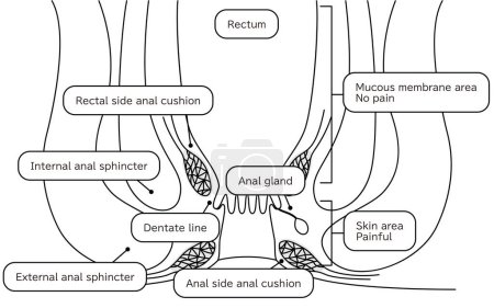 Human body rectum and anus area Illustrations, cross sectional view - Translation: Rectum, anal cushion, sphincter, mucous membrane area, skin area