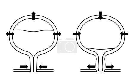 Medical Illustration of the Normal Bladder, Mechanism of Urination, Vector Illustration