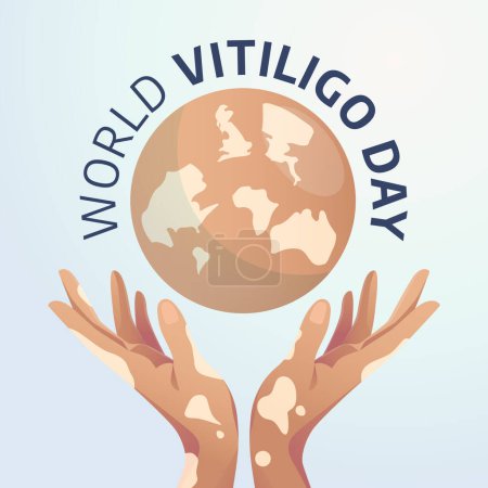 vector gráfico del mundo vitiligo día bueno para la celebración del mundo vitiligo día. diseño plano. flyer design.flat ilustración.