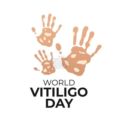 Vektorgrafik des Welt-Vitiligo-Tages ideal für die Feier des Welt-Vitiligo-Tages.