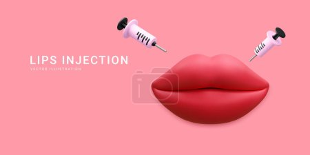 Bannière réaliste 3d pour la procédure d'augmentation des lèvres. Injection d'acide hyaluronique par les lèvres. Concept de clinique de beauté. Illustration vectorielle.