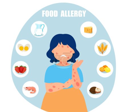 Ilustración de Vector de un niño una niña con erupción cutánea, alergia alimentaria - Imagen libre de derechos
