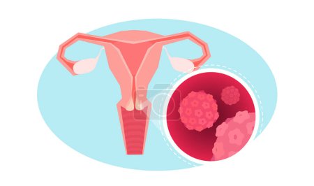 Vector de útero, trompas de Falopio y ovarios 