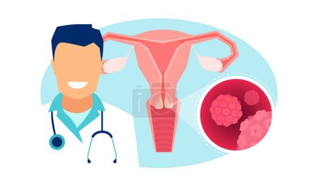 Vector of a gynecologist giving online advice on HPV infection and screening