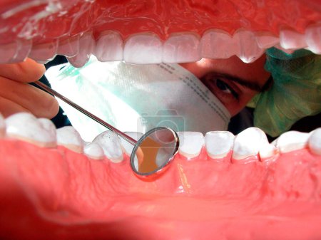 Foto de Tratamiento dental en los dientes de un paciente en el dentista - Imagen libre de derechos