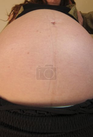 eine schwangere Frau mit Babybauch, Kind vor der Geburt