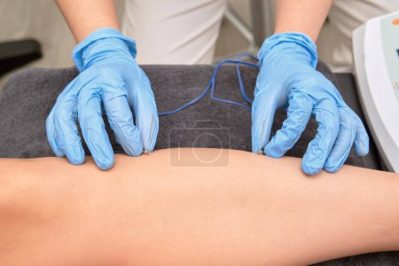 Photo for Therapeutic electroacupuncture treatment by skilled physiotherapist - Royalty Free Image
