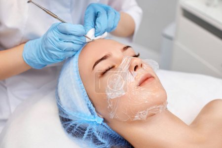 Foto de Mujer joven durante un procedimiento mecánico de limpieza de la cara en la clínica de belleza. Cosmetólogo procedimiento de fabricación para la limpieza de la piel con herramienta de acero de puntos negros y acné - Imagen libre de derechos