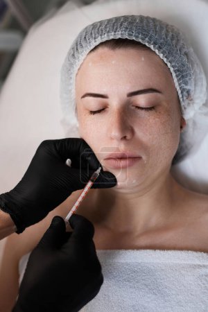 Téléchargez les photos : Femme reçoit une injection cosmétique de botox dans le visage. Femme dans un salon de beauté. chirurgie plastique. - en image libre de droit