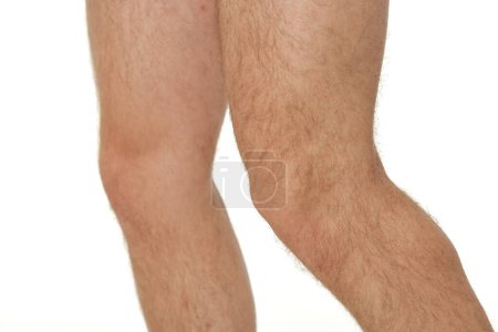 Téléchargez les photos : Jambes masculines rapprochées sur fond de studio blanc. genou - en image libre de droit