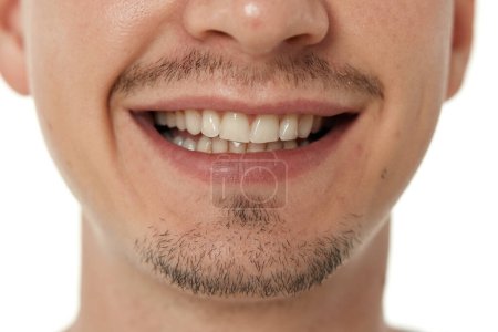 Téléchargez les photos : Bouche et les dents de l'homme souriant sur fond de studio. visage masculin avec des dents propres - en image libre de droit