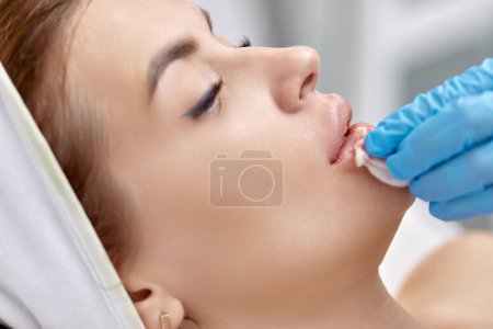Photo for Woman receives cosmetic injection in lips. Woman in beauty salon. - Royalty Free Image