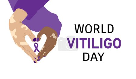 Journée mondiale du vitiligo. Mains faisant forme de coeur tenant le ruban de sensibilisation