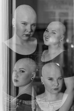 Photo for Creative positive girl, alopecia, disease. - Royalty Free Image