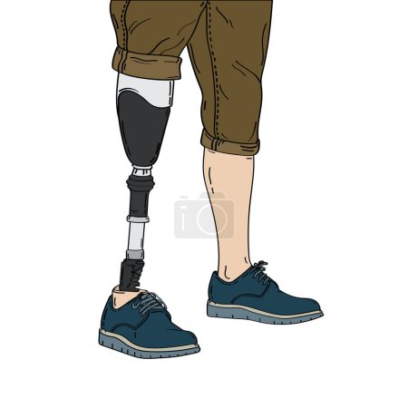Bionische Prothese eines rechten Beins.