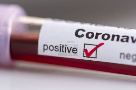 Photo for Blood sample in a test tube for coronavirus testing positive for covid-19 infection - Royalty Free Image