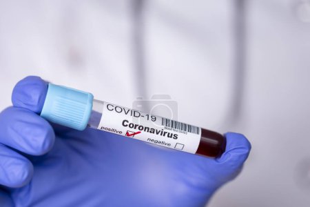 Foto de Epidemiólogo sosteniendo un tubo de ensayo con una muestra de sangre para nuevas pruebas de coronavirus - Imagen libre de derechos