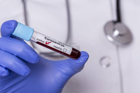 Foto de Epidemiólogo sosteniendo un tubo de ensayo con una muestra de sangre para nuevas pruebas de coronavirus; médico sosteniendo una muestra de sangre de covid-19 - Imagen libre de derechos