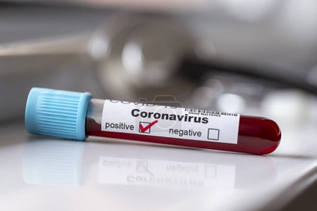 Foto de Muestra de sangre en un tubo de ensayo para la prueba de coronavirus positiva para la infección por covid-19 - Imagen libre de derechos