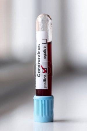 Téléchargez les photos : Échantillon de sang dans un tube à essai pour le test covid-19 positif pour une nouvelle infection par le coronavirus - en image libre de droit