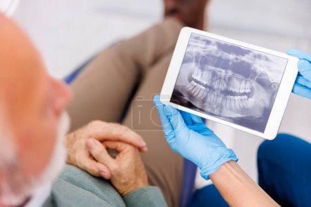 Téléchargez les photos : Vue en angle élevé du médecin montrant une radiographie de la mâchoire sur un ordinateur tablette au patient assis à la chaise dentaire au cabinet du dentiste - en image libre de droit