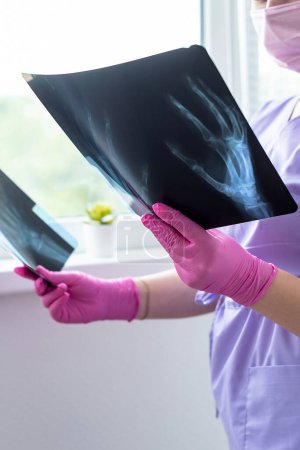Foto de Manos del doctor sosteniendo imágenes de radiografía de rayos X en la clínica. Médico, cirujano revisando la exploración de los huesos del paciente, resultado de la prueba de detección. Revisión médica, salud, concepto de radiología. - Imagen libre de derechos