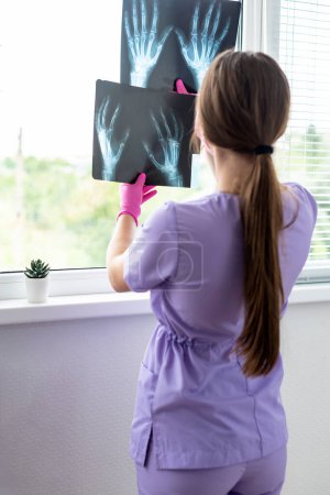 Foto de Doctora joven mirando imágenes de radiografía en la clínica. Médico, cirujano revisando la exploración de los huesos del paciente, resultado de la prueba de detección. Revisión médica, salud, concepto de radiología. - Imagen libre de derechos