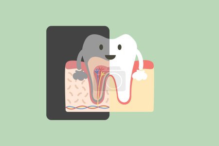 Téléchargez les illustrations : Dental x-ray, tooth holding x-ray film that showing the internal structure of the teeth - dental cartoon vector flat style cute character for design - en licence libre de droit