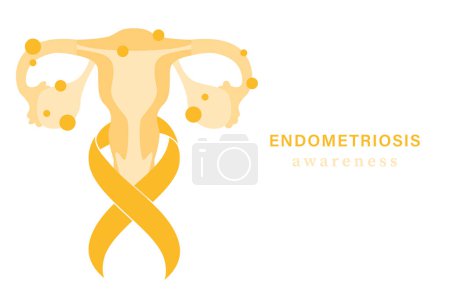 Illustration for Endometriosis awareness background. Yellow ribbbon with uterus - Royalty Free Image