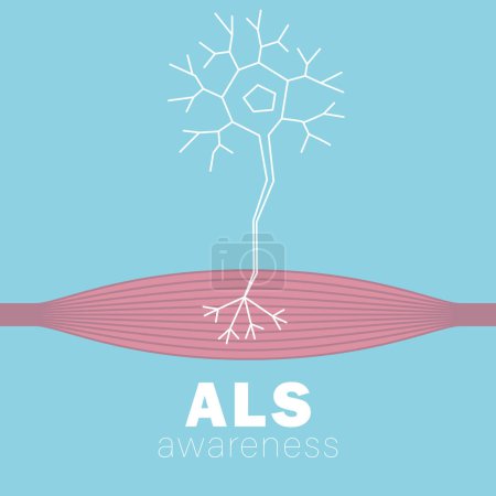 Mes de la conciencia de ALS. Esclerosis lateral amiotrófica. Ilustración del vector muscular y neuronal