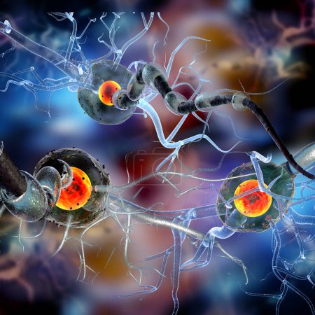 Foto de Células nerviosas, neuronas, enfermedades neurológicas, tumores, cirugía cerebral. Ilustración 3d - Imagen libre de derechos