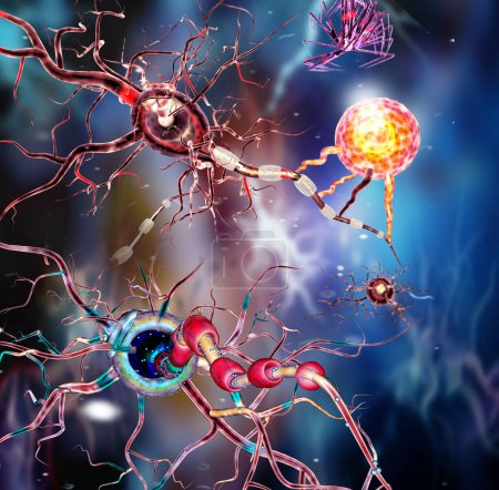 Foto de Células nerviosas, neuronas, enfermedades neurológicas, tumores, cirugía cerebral. Ilustración 3d - Imagen libre de derechos
