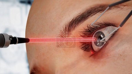 Téléchargez les photos : Laser eye surgery on 3D CGI character. 3D illustration. - en image libre de droit