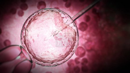 Foto de La ilustración 3D del proceso de inseminación artificial muestra espermatozoides inyectados dentro del óvulo. Ilustración 3D. - Imagen libre de derechos