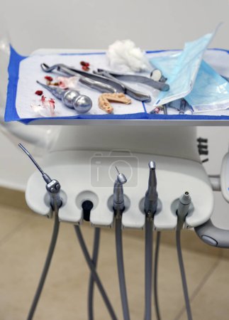Instrument dentaire de foret en acier inoxydable sur fond flou. Outils de dentisterie, médecine, équipement médical et stomatologie en clinique pour examiner les dents du patient. Forets pour dentistes.