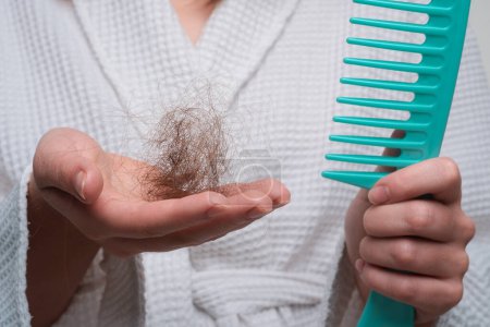 Foto de Pérdida de cabello en mujeres. Chica sosteniendo largo dañado poco saludable cabello en la mano - Imagen libre de derechos