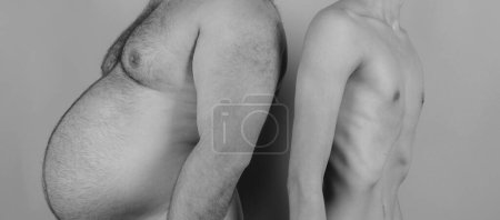 Téléchargez les photos : Homme avant et après la perte de poids. Mode de vie malsain - en image libre de droit