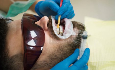 Téléchargez les photos : Dentiste féminine vérifiant les dents des patients avec miroir dans la clinique dentaire moderne. Patient ayant subi un examen dentaire à la lumière ultraviolette à la clinique dentaire. Jeune homme choisissant la couleur des dents chez le dentiste - en image libre de droit