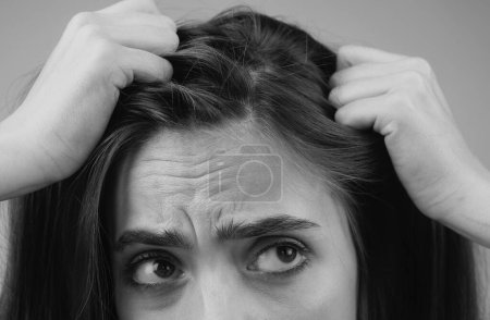 Foto de Cierra el pelo problemático. Macro cuidado del cabello y concepto de pérdida de cabello - Imagen libre de derechos