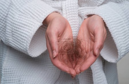 Foto de Caída de cabello. Problema de cabello en la mano, aislado. Cabello dañado poco saludable en primer plano de la mano - Imagen libre de derechos