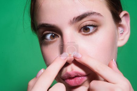 Photo for Close up Woman squeeze out pimples on nose. Acne and pimple on skin. Dermatology, puberty woman. Pimples problem. Girl Squeeze out Pimple on nose. Care from skin problem. Pimple nose - Royalty Free Image