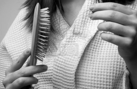 Photo for Hair loss in women. Young woman is upset because of hair loss. Problem hair in comb - Royalty Free Image