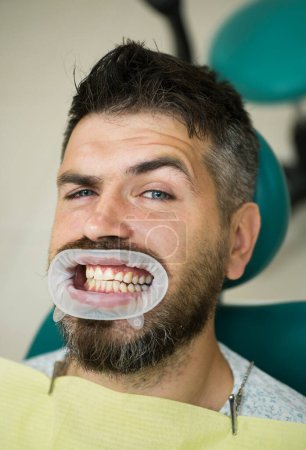 Photo for Comparison after teeth whitening. Teach patients about diets, flossing, the use of fluoride, and other aspects of dental care - Royalty Free Image