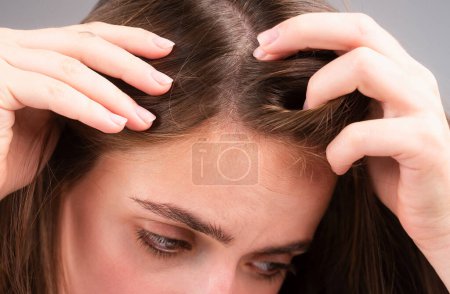 Photo for Sad woman with hair loss problem worried about hair loss - Royalty Free Image